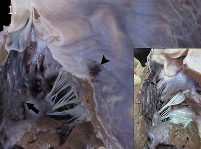 Skeletal and Cardiac Rhabdomyolysis in a Live-Stranded Neonatal Bryde's Whale With Fetal Distress